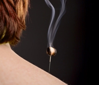 灸頭鍼（灸と鍼の併用）：イメージ